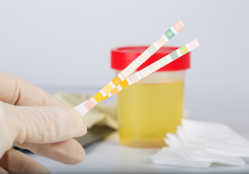How often are drug tests administered to patients in the rehab center for addicts?
